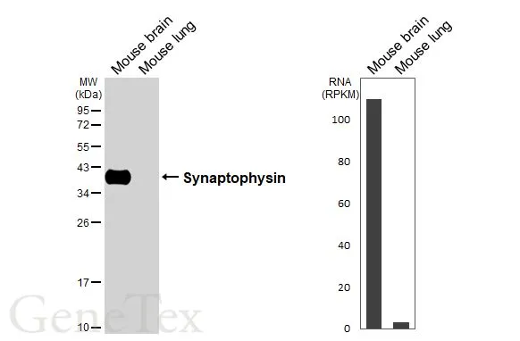 Various tissue extracts (50 μg) were separated by 12% SDS-PAGE, and the membrane was blotted with Synaptophysin antibody [GT2589] (GTX633972) diluted at 1:10000. The HRP-conjugated anti-mouse IgG antibody (GTX213111-01) was used to detect the primary antibody. Corresponding RNA expression data are based on NCBI database.