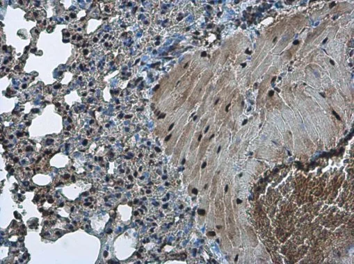 TDP43 antibody [GT6310] detects TDP43 protein at nucleus in mouse lung by immunohistochemical analysis. Sample: Paraffin-embedded mouse lung. TDP43 antibody [GT6310] (GTX633973) diluted at 1:200. 
 Antigen Retrieval: Citrate buffer, pH 6.0, 15 min