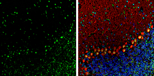 TDP43 antibody [GT6310] detects TDP43 Protein expression by immunohistochemical analysis. Sample: Frozen-sectioned adult mouse cerebellum. Green: TDP43 stained by TDP43 antibody [GT6310] (GTX633973) diluted at 1:250. Red: Calbindin, stained by Calbindin antibody (GTX130856) diluted at 1:500. Blue: Fluoroshield with DAPI (GTX30920). 
 Antigen Retrieval: Citrate buffer, pH 6.0, 5 min