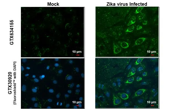 Immunofluorescent analysis of arboviruses infected cells using Zika virus Envelope protein antibody [GT363] (GTX634155). Sample: Mock and zika virus-infected cells. Green: Zika virus Envelope protein antibody [GT363] (GTX634155) diluted at 1:100.