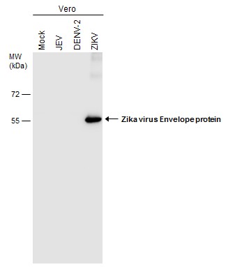 Immunofluorescent analysis of non-infected and infected vero cells using Zika virus Envelope protein antibody [GT871] (GTX634157). Green: Zika virus Envelope protein antibody [GT871] (GTX634157) diluted at 1:500.