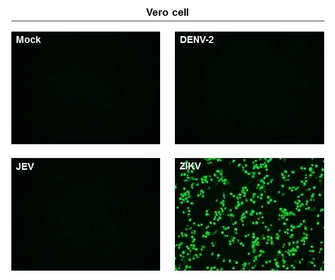 Immunofluorescent analysis of non-infected and infected vero cells using Zika virus Envelope protein antibody [GT871] (GTX634157). Green: Zika virus Envelope protein antibody [GT871] (GTX634157) diluted at 1:500.