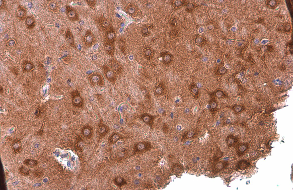 PYK2 antibody [GT858]