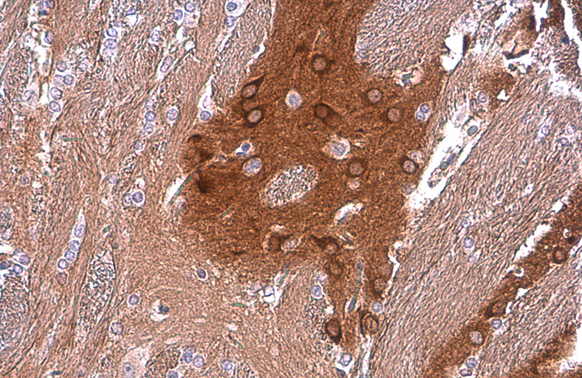 PYK2 antibody [GT858]