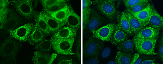 Anterior Gradient 2 antibody [GT5812] detects Anterior Gradient 2 protein at endoplasmic reticulum by immunofluorescent analysis. Sample: MCF-7 cells were fixed in 4% paraformaldehyde at RT for 15 min. Green: Anterior Gradient 2 stained by Anterior Gradient 2 antibody [GT5812] (GTX634163) diluted at 1:500. Blue: Hoechst 33342 staining.