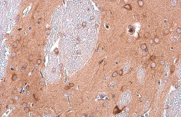 EEA1 antibody [GT10811]
