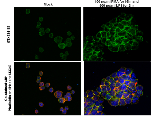 Anti-IL1 beta antibody [GT289] (GTX634188) | GeneTex