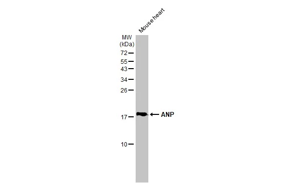 Mouse tissue extract (50 μg) was separated by 15% SDS-PAGE, and the membrane was blotted with ANP antibody [GT1068] (GTX634219) diluted at 1:1000. The HRP-conjugated anti-mouse IgG antibody (GTX213111-01) was used to detect the primary antibody.