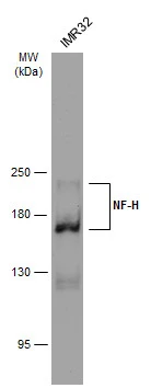 NF-H antibody [GT114] detects NF-H protein at cytoplasm in rat brain by immunohistochemical analysis.Sample: Paraffin-embedded rat brain.NF-H antibody [GT114] (GTX634289) diluted at 1:500.Scale bar = 1 um. Antigen Retrieval: Citrate buffer,pH 6.0,15 min