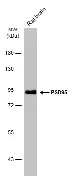 Rat tissue extract (50 μg) was separated by 7.5% SDS-PAGE, and the membrane was blotted with PSD95 antibody [GT1436] (GTX634290) diluted at 1:1000. The HRP-conjugated anti-mouse IgG antibody (GTX213111-01) was used to detect the primary antibody.