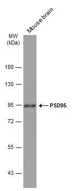 Mouse tissue extract (50 μg) was separated by 7.5% SDS-PAGE, and the membrane was blotted with PSD95 antibody [GT1436] (GTX634290) diluted at 1:1000. The HRP-conjugated anti-mouse IgG antibody (GTX213111-01) was used to detect the primary antibody.