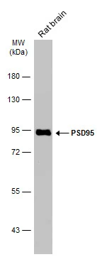 Rat tissue extract (50 μg) was separated by 7.5% SDS-PAGE, and the membrane was blotted with PSD95 antibody [GT1234] (GTX634291) diluted at 1:5000. The HRP-conjugated anti-mouse IgG antibody (GTX213111-01) was used to detect the primary antibody.