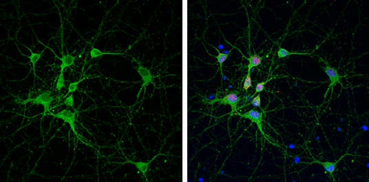 PSD95 antibody [GT1234] detects PSD95 protein by immunofluorescent analysis. Sample: DIV9 rat E18 primary cortical neuron cells were fixed in 4% paraformaldehyde at RT for 15 min. Green: PSD95 stained by PSD95 antibody [GT1234] (GTX634291) diluted at 1:500. Red: NeuN, stained by NeuN antibody (GTX132974) diluted at 1:500. Blue: Fluoroshield with DAPI (GTX30920).