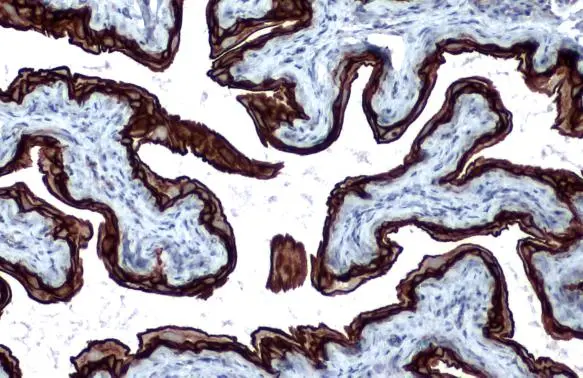 Cytokeratin 5 antibody [GT1486] detects Cytokeratin 5 protein at cell membrane by immunohistochemical analysis. Sample: Paraffin-embedded mouse urinary bladder. Cytokeratin 5 stained by Cytokeratin 5 antibody [GT1486] (GTX634308) diluted at 1:200. Antigen Retrieval: Citrate buffer, pH 6.0, 15 min
