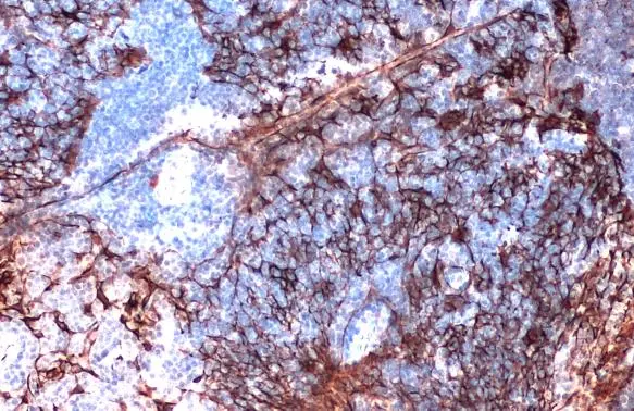 Cytokeratin 5 antibody [GT1486] detects Cytokeratin 5 protein at cell membrane by immunohistochemical analysis. Sample: Paraffin-embedded rat thymus gland. Cytokeratin 5 stained by Cytokeratin 5 antibody [GT1486] (GTX634308) diluted at 1:200. Antigen Retrieval: Citrate buffer, pH 6.0, 15 min
