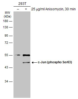 Untreated (�) and treated (+) 293T whole cell extracts (30 ug) were separated by 10% SDS-PAGE,and the membrane was blotted with c-Jun (phospho Ser63) antibody [GT653] (GTX634322) diluted at 1:1000.
