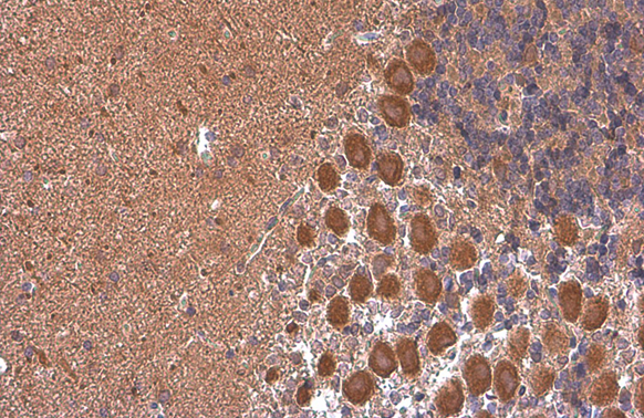 Rheb antibody [GT39810] detects Rheb protein at cytoplasm by immunohistochemical analysis. Sample:Paraffin-embedded rat brain. Rheb stained by Rheb antibody [GT39810] (GTX634335) diluted at 1:200. Antigen Retrieval:Citrate buffer,pH 6.0,15 min