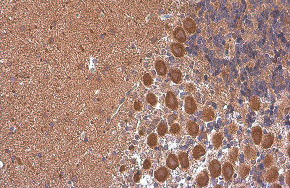 Rheb antibody [GT39810] detects Rheb protein at cytoplasm by immunohistochemical analysis. Sample: Paraffin-embedded rat brain. Rheb stained by Rheb antibody [GT39810] (GTX634335) diluted at 1:200. Antigen Retrieval: Citrate buffer, pH 6.0, 15 min