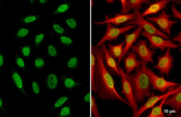 SP1 antibody [GT2574] detects SP1 protein at nucleus by immunofluorescent analysis. Sample: HeLa cells were fixed in 4% paraformaldehyde at RT for 15 min. Green: SP1 stained by SP1 antibody [GT2574] (GTX634352) diluted at 1:500. Red: beta Tubulin, a cytoskeleton marker, stained by beta Tubulin antibody (GTX101279) diluted at 1:1000. Scale bar= 10μm.