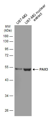 U87-MG whole cell and nuclear extracts (30 μg) were separated by 10% SDS-PAGE, and the membrane was blotted with PAX3 antibody [GT2411] (GTX634389) diluted at 1:1000. The HRP-conjugated anti-mouse IgG antibody (GTX213111-01) was used to detect the primary antibody.