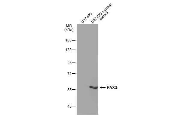 PAX3 antibody [GT1210]