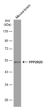 Mouse tissue extract (50 μg) was separated by 10% SDS-PAGE, and the membrane was blotted with PPP2R2D antibody[GT577] (GTX634398) diluted at 1:1000. The HRP-conjugated anti-mouse IgG antibody (GTX213111-01) was used to detect the primary antibody.
