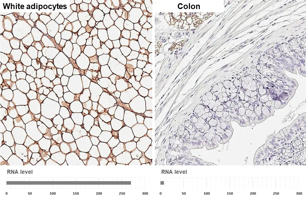 Anti-Perilipin 1 antibody [GT2781] (GTX634406) | GeneTex
