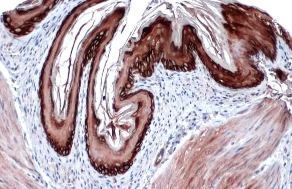 Cytokeratin 14 antibody [GT985] detects Cytokeratin 14 protein at cytoplasm by immunohistochemical analysis. Sample: Paraffin-embedded mouse esophagus. Cytokeratin 14 stained by Cytokeratin 14 antibody [GT985] (GTX634409) diluted at 1:200. Antigen Retrieval: Citrate buffer, pH 6.0, 15 min