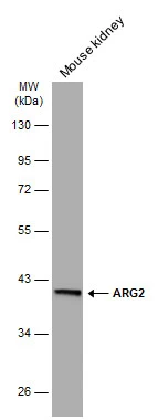 ARG2 antibody [GT11111]
