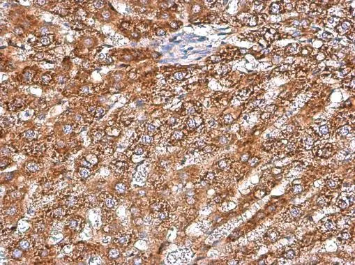 ARG2 antibody [GT11111]