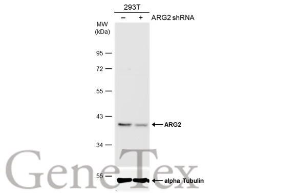 ARG2 antibody [GT11111]