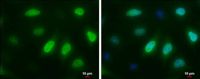 Cyclin A2 antibody [GT2547] detects Cyclin A2 protein at cytoplasm and nucleus by immunofluorescent analysis. Sample: HeLa cells were fixed in 4% paraformaldehyde at RT for 15 min. Green: Cyclin A2 stained by Cyclin A2 antibody [GT2547] (GTX634420) diluted at 1:500. Blue: Hoechst 33342 staining. Scale bar= 10μm.
