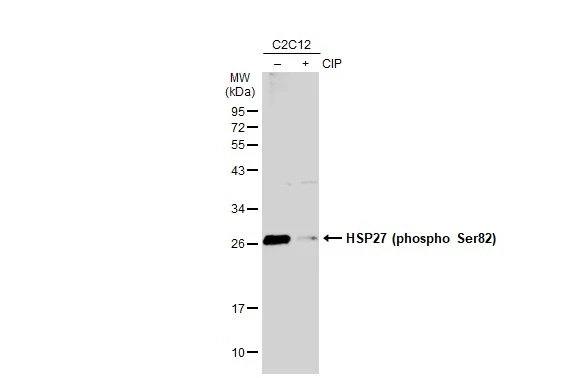 Anti-HSP27 (phospho Ser82) antibody [GT357] (GTX634421