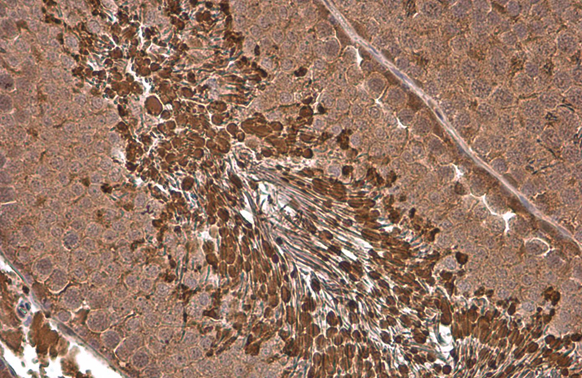 PGK1 antibody [GT21612]