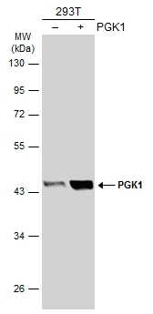 PGK1 antibody [GT21612]