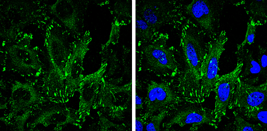 VASP antibody [GT238]