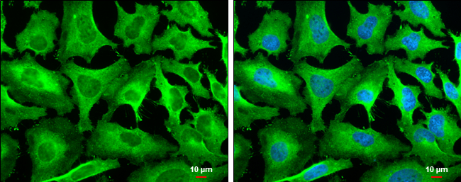 HSP27 antibody [GT6310] detects HSP27 protein at cytoplasm by immunofluorescent analysis. Sample: HeLa cells were fixed in 4% paraformaldehyde at RT for 15 min. Green: HSP27 stained by HSP27 antibody [GT6310] (GTX634459) diluted at 1:500. Blue: Hoechst 33342 staining. Scale bar= 10μm.