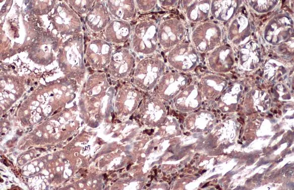 HSP27 antibody [GT6310] detects HSP27 protein at cytoplasm by immunohistochemical analysis. Sample: Paraffin-embedded rat colon. HSP27 stained by HSP27 antibody [GT6310] (GTX634459) diluted at 1:200. Antigen Retrieval: Citrate buffer, pH 6.0, 15 min