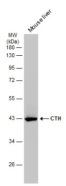 Mouse tissue extract (50 μg) was separated by 10% SDS-PAGE, and the membrane was blotted with CTH antibody [GT1657] (GTX634460) diluted at 1:5000. The HRP-conjugated anti-mouse IgG antibody (GTX213111-01) was used to detect the primary antibody.
