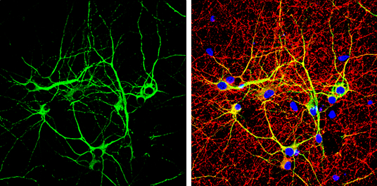 MAP2 antibody [GT378] detects MAP2 protein in dendrites, but not in axons, by immunofluorescent analysis. Sample: DIV10 rat E18 primary cortical neuron cells were fixed in 4% paraformaldehyde at RT for 15 min. Green: Dendrite marker MAP2 stained by MAP2 antibody [GT378] (GTX634471) diluted at 1:1000. Red: Axon marker Tau, stained by Tau antibody (GTX130462) diluted at 1:500. Blue: Fluoroshield with DAPI (GTX30920).