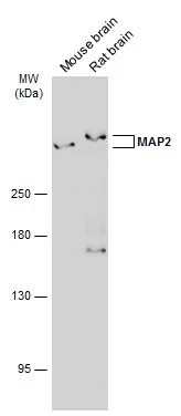 Various tissue extracts (50 μg) were separated by 5% SDS-PAGE, and the membrane was blotted with MAP2 antibody [GT378] (GTX634471) diluted at 1:1000. The HRP-conjugated anti-mouse IgG antibody (GTX213111-01) was used to detect the primary antibody.
