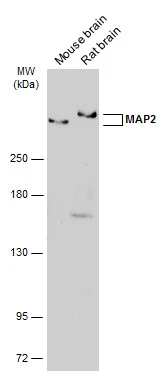 Various tissue extracts (50 μg) were separated by 5% SDS-PAGE, and the membrane was blotted with MAP2 antibody [GT925] (GTX634473) diluted at 1:6000. The HRP-conjugated anti-mouse IgG antibody (GTX213111-01) was used to detect the primary antibody.
