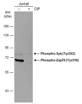 Untreated (–) and treated (+) Jurkat whole cell extracts (30 μg) were separated by 7.5% SDS-PAGE, and the membrane was blotted with Zap70 (phospho Tyr319) + Syk (phospho Tyr352) antibody [GT364] (GTX634476) diluted at 1:1000. The HRP-conjugated anti-mouse IgG antibody (GTX213111-01) was used to detect the primary antibody.