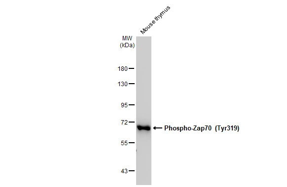 Mouse tissue extract (50 μg) was separated by 7.5% SDS-PAGE, and the membrane was blotted with ZAP70 (phospho Tyr319) / Syk (phospho Tyr352) antibody [GT364] (GTX634476) diluted at 1:1000. The HRP-conjugated anti-mouse IgG antibody (GTX213111-01) was used to detect the primary antibody.