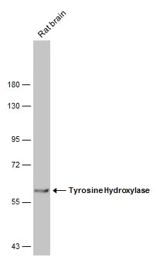 Rat tissue extract (50 μg) was separated by 7.5% SDS-PAGE, and the membrane was blotted with Tyrosine Hydroxylase antibody [GT234] (GTX634481) diluted at 1:1000. The HRP-conjugated anti-mouse IgG antibody (GTX213111-01) was used to detect the primary antibody.