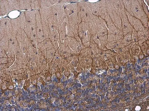 NF-M antibody [GT883]