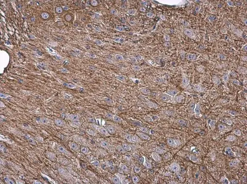 NF-M antibody [GT883]
