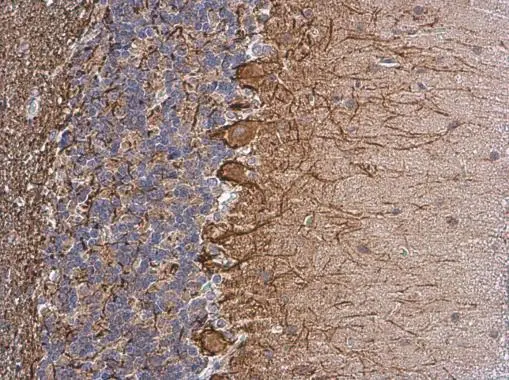NF-M antibody [GT883]