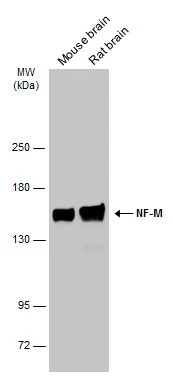 NF-M antibody [GT883] detects NF-M protein at by immunohistochemical analysis. Sample: Paraffin-embedded rat brain. NF-M stained by NF-M antibody [GT883] (GTX634483) diluted at 1:200. Antigen Retrieval: Citrate buffer,pH 6.0,15 min