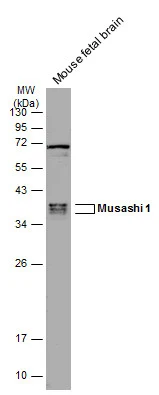 Mouse tissue extract (50 μg) was separated by 12% SDS-PAGE, and the membrane was blotted with Musashi 1 antibody [GT2377] (GTX634485) diluted at 1:1000. The HRP-conjugated anti-mouse IgG antibody (GTX213111-01) was used to detect the primary antibody.